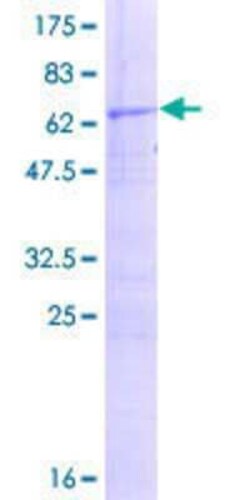 Novus Biologicals Recombinant Human RG9MTD3 GST (N-Term) Protein 25 &mu;g | Buy Online | Novus Biologicals&trade; | Fisher Scientific