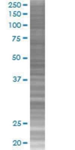 Novus Biologicals&trade;&nbsp;ZNF483 293T Cell Transient Overexpression Lysate
