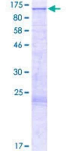 Novus Biologicals Recombinant Human FAM47A GST (N-Term) Protein 2 &mu;g | Buy Online | Novus Biologicals&trade; | Fisher Scientific