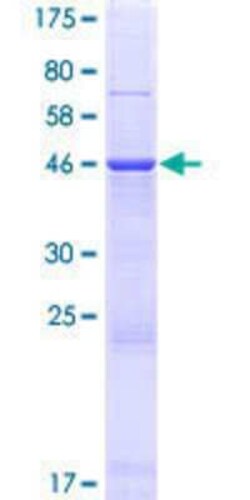 Novus Biologicals Recombinant Human AKAP14 GST (N-Term) Protein 25 &mu;g | Buy Online | Novus Biologicals&trade; | Fisher Scientific