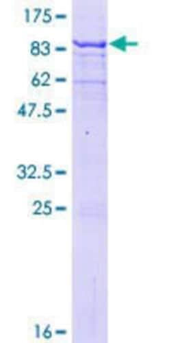 Novus Biologicals Recombinant Human MAGEB6 GST (N-Term) Protein 25 &mu;g | Buy Online | Novus Biologicals&trade; | Fisher Scientific