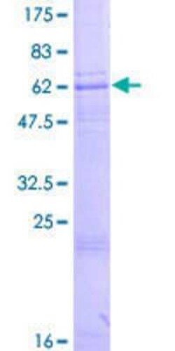 Novus Biologicals Recombinant Human ZDHHC15 GST (N-Term) Protein 10 &mu;g | Buy Online | Novus Biologicals&trade; | Fisher Scientific