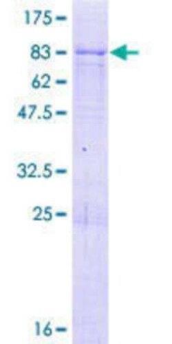 Novus Biologicals Recombinant Human RBMY1F GST (N-Term) Protein 2 &mu;g | Buy Online | Novus Biologicals&trade; | Fisher Scientific
