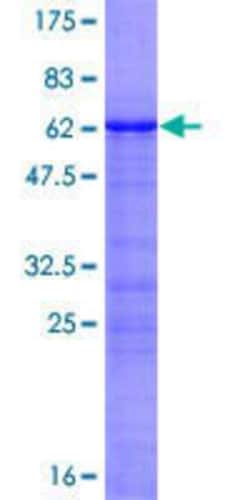 Novus Biologicals&trade;&nbsp;Recombinant Human NKX2.3 GST (N-Term) Protein