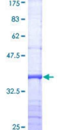 Novus Biologicals Recombinant Human DGKH GST (N-Term) Protein 25 &mu;g | Buy Online | Novus Biologicals&trade; | Fisher Scientific
