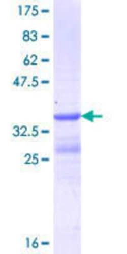 Novus Biologicals Recombinant Human STRC GST (N-Term) Protein 10 &mu;g | Buy Online | Novus Biologicals&trade; | Fisher Scientific