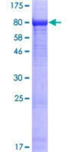 Novus Biologicals Recombinant Human EXD1 GST (N-Term) Protein 10 &mu;g | Buy Online | Novus Biologicals&trade; | Fisher Scientific