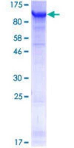 Novus Biologicals Recombinant Human FSIP1 GST (N-Term) Protein 25 &mu;g | Buy Online | Novus Biologicals&trade; | Fisher Scientific