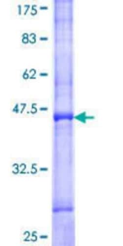 Novus Biologicals Recombinant Human Vanilloid R-like 3/TRPV3 GST (N-Term) Protein 10 &mu;g | Buy Online | Novus Biologicals&trade; | Fisher Scientific