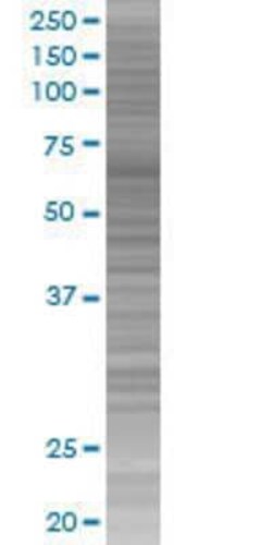 Novus Biologicals ZNF342 293T Cell Transient Overexpression Lysate 0.1 mL | Buy Online | Novus Biologicals&trade; | Fisher Scientific