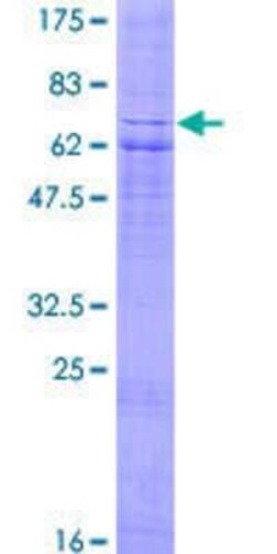 Novus Biologicals Recombinant Human OXER1/5-oxo-ETE GPCR GST (N-Term) Protein 2 &mu;g | Buy Online | Novus Biologicals&trade; | Fisher Scientific