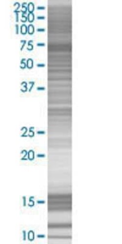 Novus Biologicals&trade;&nbsp;BBS12 293T Cell Transient Overexpression Lysate
