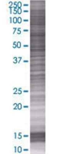 Novus Biologicals&trade;&nbsp;TRIM60 293T Cell Transient Overexpression Lysate