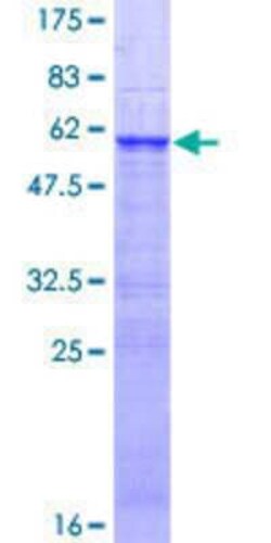 Novus Biologicals Recombinant Human ZNF509 GST (N-Term) Protein 10 &mu;g | Buy Online | Novus Biologicals&trade; | Fisher Scientific