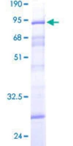 Novus Biologicals Recombinant Human DCP2 GST (N-Term) Protein 25 &mu;g | Buy Online | Novus Biologicals&trade; | Fisher Scientific
