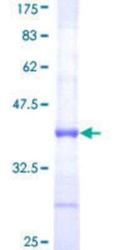 Novus Biologicals Recombinant Human ZNF92 GST (N-Term) Protein 25 &mu;g | Buy Online | Novus Biologicals&trade; | Fisher Scientific