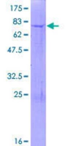 Novus Biologicals Recombinant Human GALNTL5 GST (N-Term) Protein 10 &mu;g | Buy Online | Novus Biologicals&trade; | Fisher Scientific