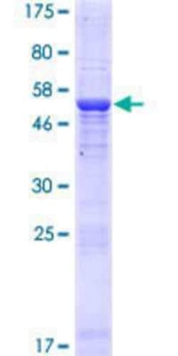 Novus Biologicals Recombinant Human THAP5 GST (N-Term) Protein 25 &mu;g | Buy Online | Novus Biologicals&trade; | Fisher Scientific
