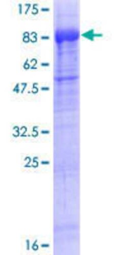 Novus Biologicals Recombinant Human SgK071 GST (N-Term) Protein 10 &mu;g | Buy Online | Novus Biologicals&trade; | Fisher Scientific