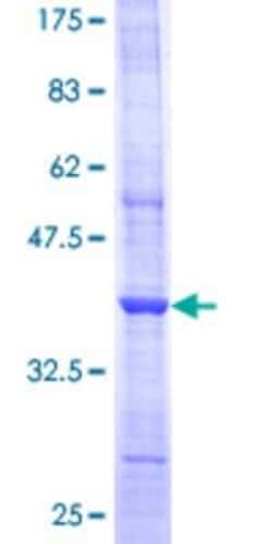 Novus Biologicals Recombinant Human ARX GST (N-Term) Protein 10 &mu;g | Buy Online | Novus Biologicals&trade; | Fisher Scientific