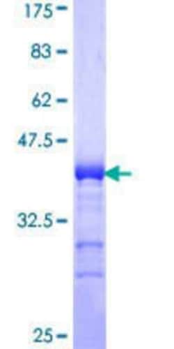 Novus Biologicals Recombinant Human ADAMTS17 GST (N-Term) Protein 10 &mu;g | Buy Online | Novus Biologicals&trade; | Fisher Scientific