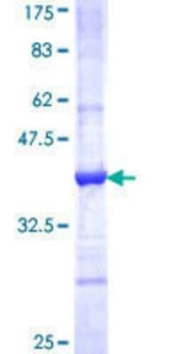 Novus Biologicals Recombinant Human Kv6.3 GST (N-Term) Protein 25 &mu;g | Buy Online | Novus Biologicals&trade; | Fisher Scientific