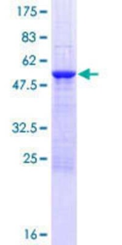 Novus Biologicals Recombinant Human FAM9B GST (N-Term) Protein 25 &mu;g | Buy Online | Novus Biologicals&trade; | Fisher Scientific