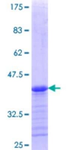 Novus Biologicals Recombinant Human FAM9B GST (N-Term) Protein 10 &mu;g | Buy Online | Novus Biologicals&trade; | Fisher Scientific