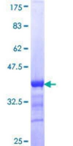 Novus Biologicals Recombinant Human KRT24 GST (N-Term) Protein 25 &mu;g | Buy Online | Novus Biologicals&trade; | Fisher Scientific