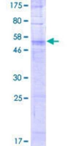 Novus Biologicals Recombinant Human OR56B4 GST (N-Term) Protein 2 &mu;g | Buy Online | Novus Biologicals&trade; | Fisher Scientific