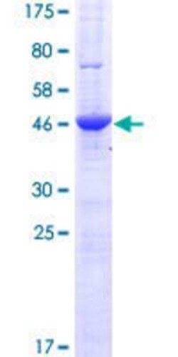 Novus Biologicals&trade;&nbsp;Recombinant Human AMN1 GST (N-Term) Protein