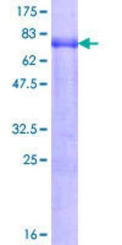 Novus Biologicals Recombinant Human PSRC2 GST (N-Term) Protein 10 &mu;g | Buy Online | Novus Biologicals&trade; | Fisher Scientific