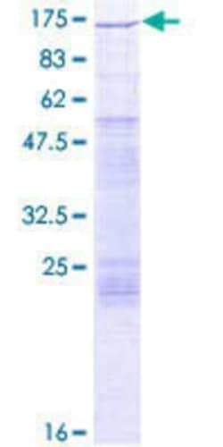Novus Biologicals Recombinant Human FUK GST (N-Term) Protein 2 &mu;g | Buy Online | Novus Biologicals&trade; | Fisher Scientific