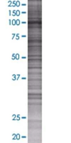 Novus Biologicals&trade;&nbsp;FUK 293T Cell Transient Overexpression Lysate
