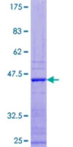 Novus Biologicals Recombinant Human APOBEC3F GST (N-Term) Protein 10 &mu;g | Buy Online | Novus Biologicals&trade; | Fisher Scientific