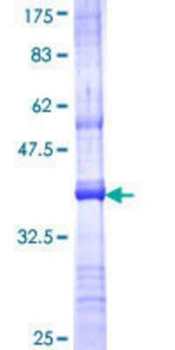 Novus Biologicals Recombinant Human APOBEC3F GST (N-Term) Protein 25 &mu;g | Buy Online | Novus Biologicals&trade; | Fisher Scientific