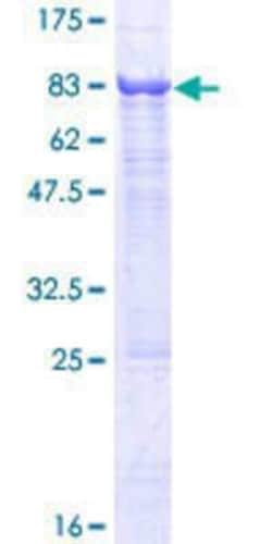 Novus Biologicals Recombinant Human DNAH6 GST (N-Term) Protein 25 &mu;g | Buy Online | Novus Biologicals&trade; | Fisher Scientific