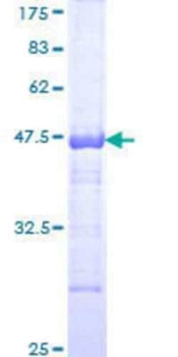 Novus Biologicals Recombinant Human PIKFyve/PIP5K3 GST (N-Term) Protein 25 &mu;g | Buy Online | Novus Biologicals&trade; | Fisher Scientific