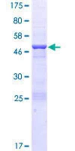 Novus Biologicals Recombinant Human CCDC46 GST (N-Term) Protein 25 &mu;g | Buy Online | Novus Biologicals&trade; | Fisher Scientific