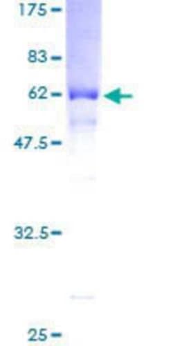 Novus Biologicals Recombinant Human Folliculin GST (N-Term) Protein 2 &mu;g | Buy Online | Novus Biologicals&trade; | Fisher Scientific