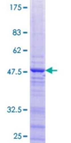 Novus Biologicals Recombinant Human ZNF385C GST (N-Term) Protein 25 &mu;g | Buy Online | Novus Biologicals&trade; | Fisher Scientific