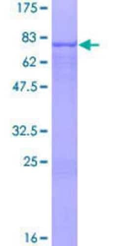 Novus Biologicals Recombinant Human ZSCAN4 GST (N-Term) Protein 25 &mu;g | Buy Online | Novus Biologicals&trade; | Fisher Scientific