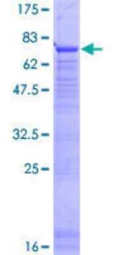 Novus Biologicals&trade;&nbsp;Recombinant Human PTPLB GST (N-Term) Protein