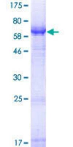 Novus Biologicals Recombinant Human SLC10A4 GST (N-Term) Protein 25 &mu;g | Buy Online | Novus Biologicals&trade; | Fisher Scientific