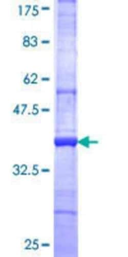 Novus Biologicals Recombinant Human STK32A GST (N-Term) Protein 10 &mu;g | Buy Online | Novus Biologicals&trade; | Fisher Scientific