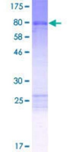 Novus Biologicals Recombinant Human ANKS6 GST (N-Term) Protein 2 &mu;g | Buy Online | Novus Biologicals&trade; | Fisher Scientific