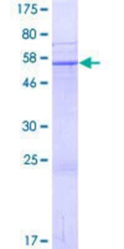 Novus Biologicals Recombinant Human SUSD3 GST (N-Term) Protein 2 &mu;g | Buy Online | Novus Biologicals&trade; | Fisher Scientific