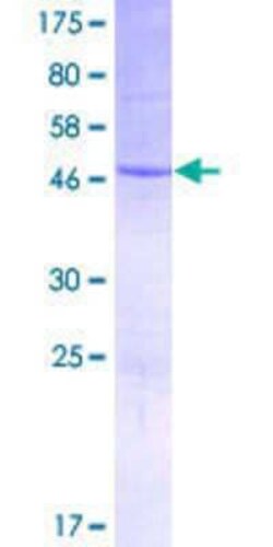 Novus Biologicals Recombinant Human RPSAP52 GST (N-Term) Protein 10 &mu;g | Buy Online | Novus Biologicals&trade; | Fisher Scientific