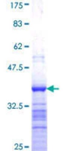 Novus Biologicals Recombinant Human LASS3 GST (N-Term) Protein 25 &mu;g | Buy Online | Novus Biologicals&trade; | Fisher Scientific