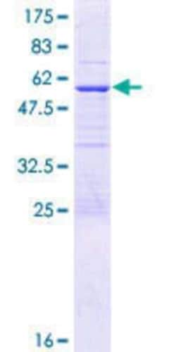 Novus Biologicals Recombinant Human enkurin GST (N-Term) Protein 25 &mu;g | Buy Online | Novus Biologicals&trade; | Fisher Scientific